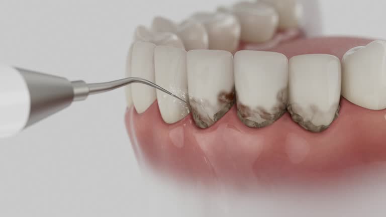 Reliable Dental Implants contractor in Shelby, MT by Smile Center Dentistry